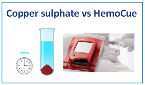 blood drop test copper sulfate iron|nhs blood test for iron.